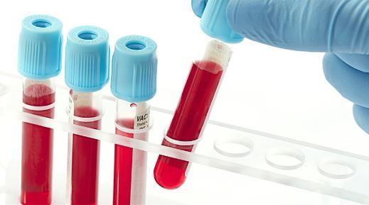Blood in test tubes image